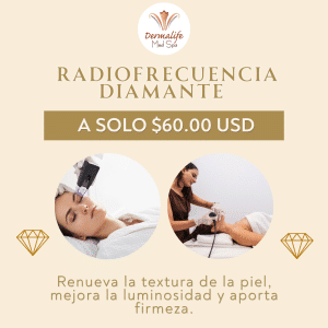Radiofrecuencia Diamante